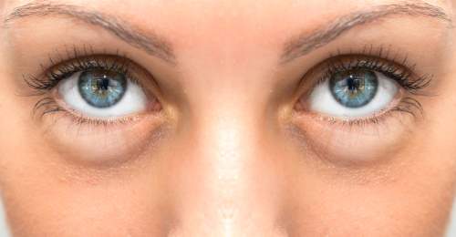 Thyroid Dysfunction Quiz - Question 4